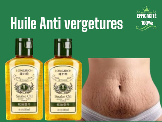 RIDES ET VERGETURE