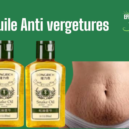 ANTI-VERGETURE